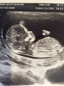 Baby #4 at 13 weeks.
